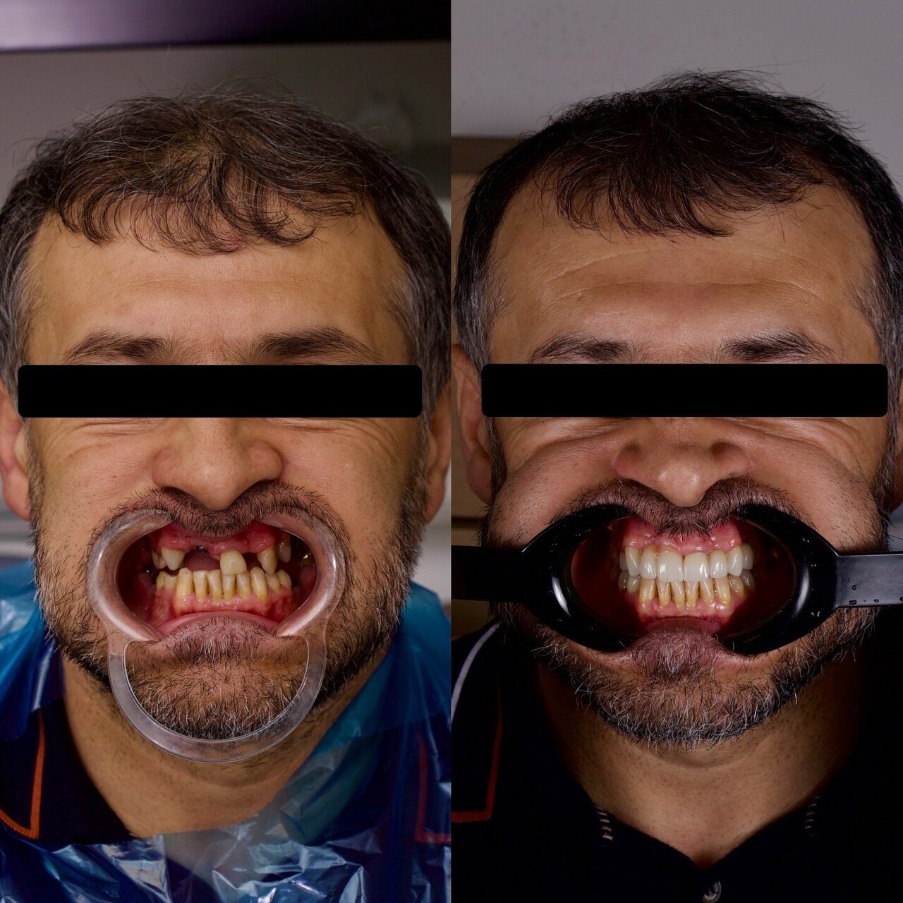 Клинический случай до и после