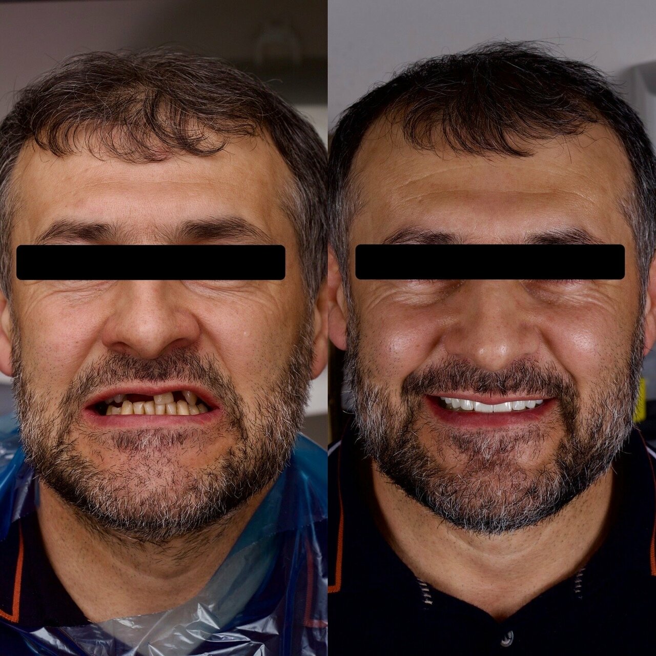 Клинический результат пациента